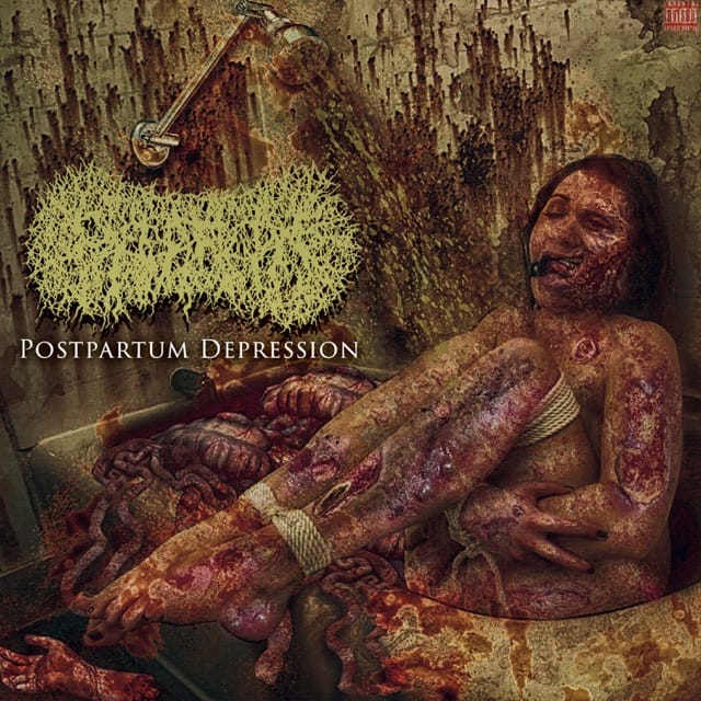 Postpartum Depression