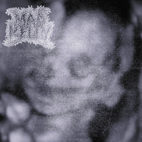 000/1999