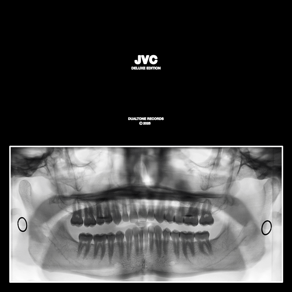 JVC (Deluxe Edition)