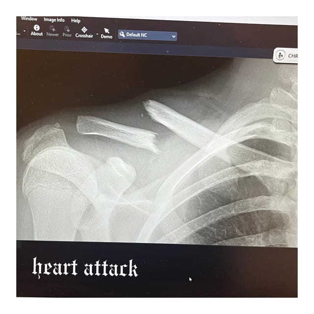 heart attack demo - Single