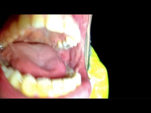 Amnesia Scanner — Amnesia Scanner - AS A.W.O.L