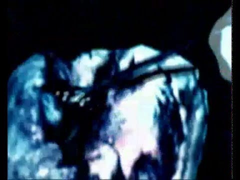 Kruton — kruton: smallfish pa track 2 (autechre remix)
