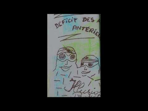 DDAA — déficit des années antérieures - déficit des années antérieures (full)