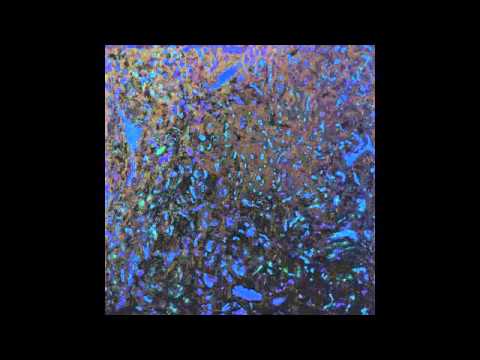 Zenker Brothers — Zenker Brothers - Phing