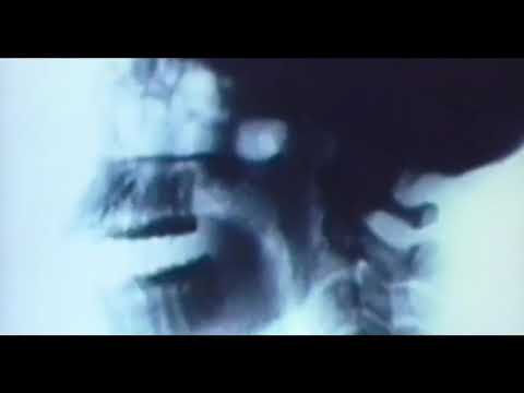 The Offspring — The Offspring - Self Esteem (Official Video)