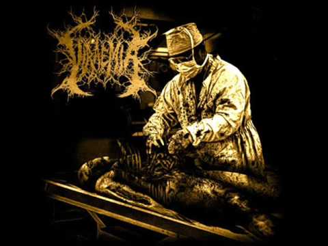 Viraemia — Viraemia The Prodromal Phase