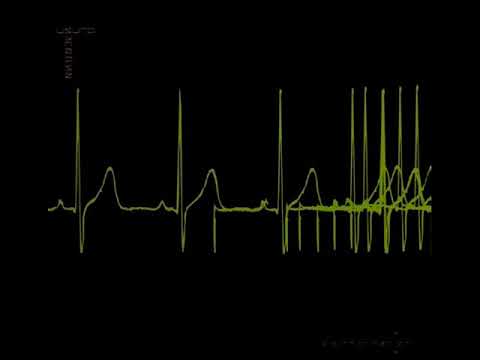 Usurp Synapse — Usurp Synapse - Disinformation Fix (Discography)