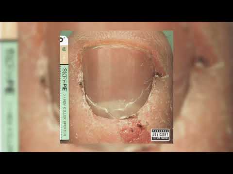 Skrape — Skrape - I Know