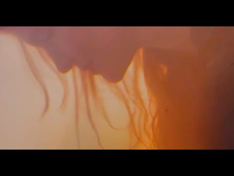 WOOM — Welts