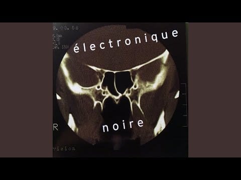 Eivind Aarset — Porcupine Night Walk