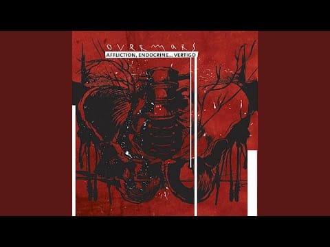 Overmars (2) — Obsolete