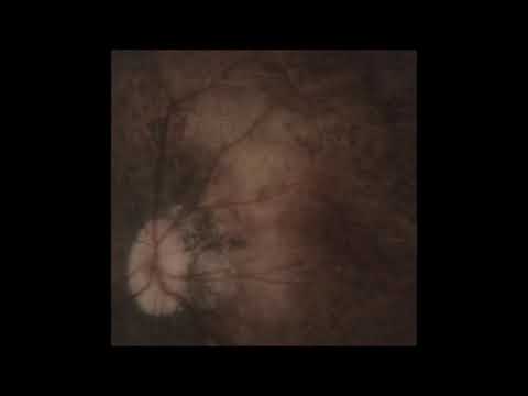 Pale Spektre — Pale Spektre - Bereft of Xerotic Layers (Full Album)