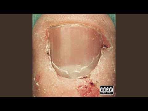 Skrape — Isolated