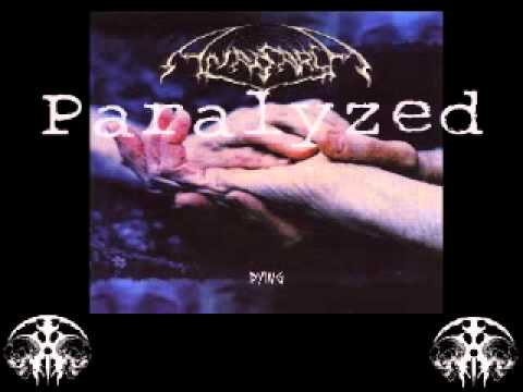 Anasarca — Anasarca - Paralyzed