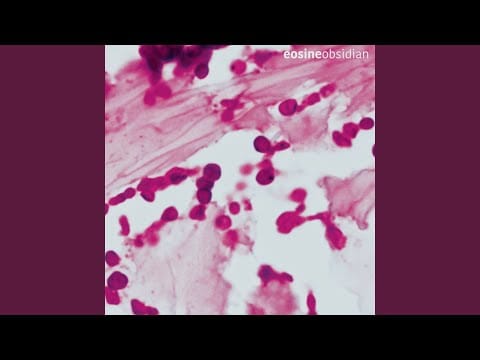 Eosine — Inner You