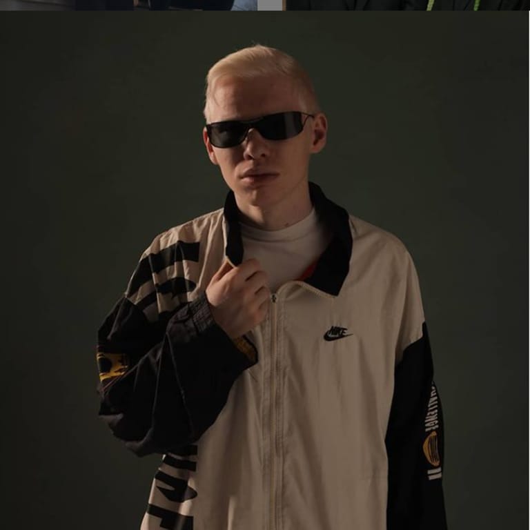 Albino
