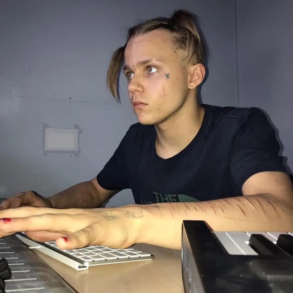 Yung Skitz