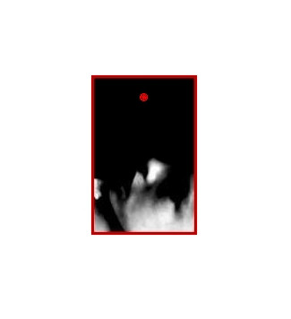 Aseptic Void