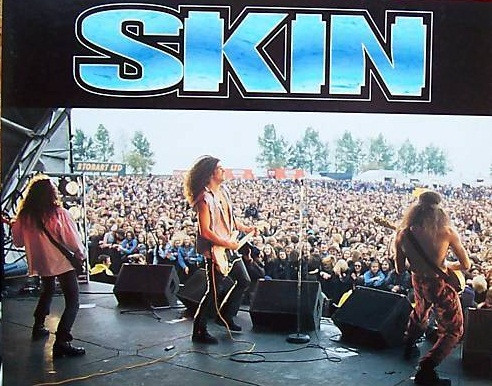 Skin (4)