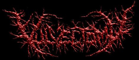 Vulvectomy